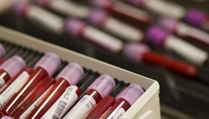 Uvećane kazne za doping Uvećane kazne za doping