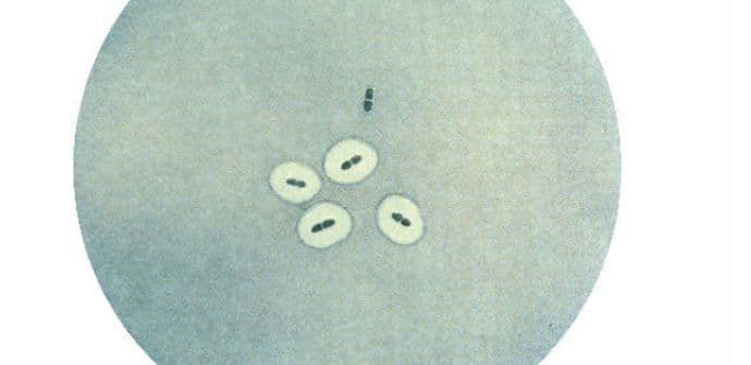 Vitamin E pomaže liječenju upale pluća  Vitamin E pomaže liječenju upale pluća