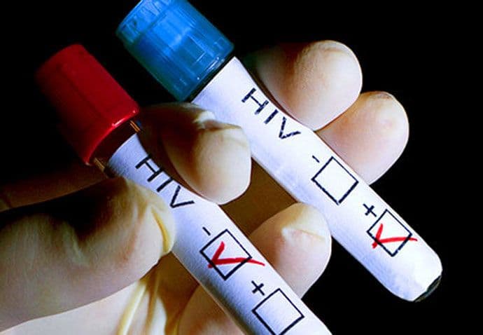 Dan: Trećina zdravstvenih radnika misli da komarci prenose sidu Dan: Trećina zdravstvenih radnika misli da komarci prenose sidu