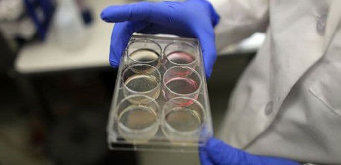 Matične ćelije obnavljaju kosti Matične ćelije obnavljaju kosti