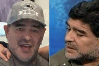 Maradona nakon "fejsliftinga" (FOTO)
