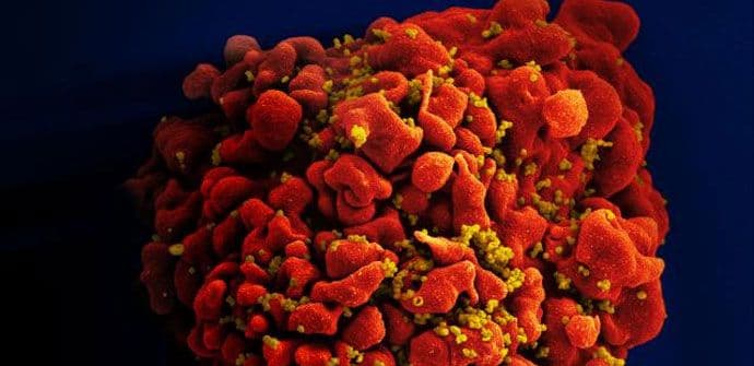 Naučnici otkrili agresivniji soj HIV-a Naučnici otkrili agresivniji soj HIV-a