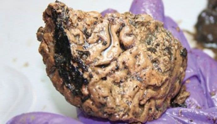 Iz blata izvukli mozak star 2.600 godina! Iz blata izvukli mozak star 2.600 godina!