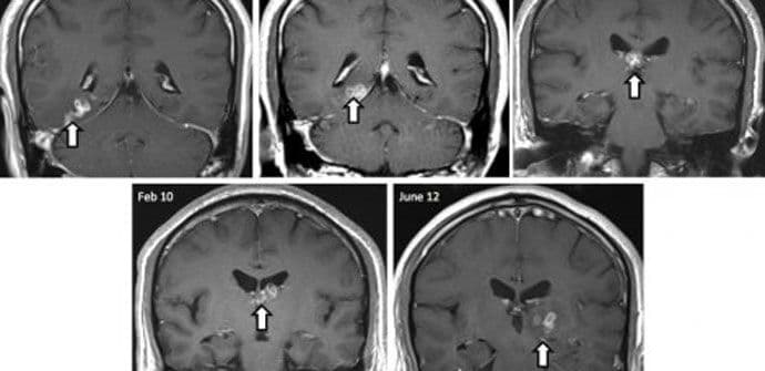 Šta se događa u mozgu neposredno pred smrt? Šta se događa u mozgu neposredno pred smrt?