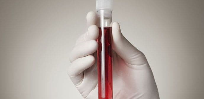 Vađenje krvi od naredne godine obavljaće se bez igle Vađenje krvi od naredne godine obavljaće se bez igle