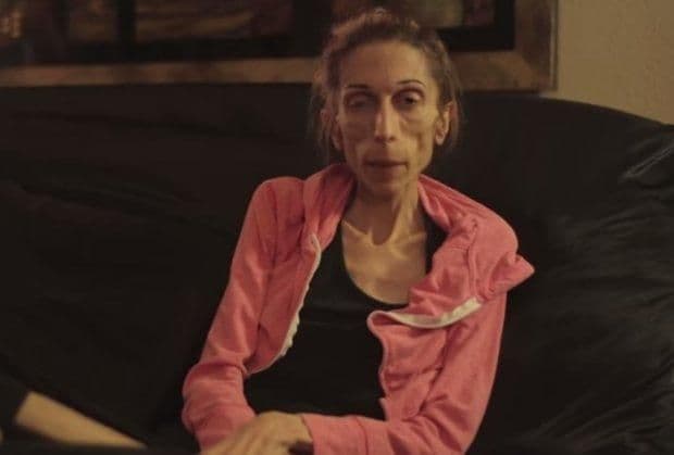 Moli za pomoć: Glumica ima 19 kilograma i nijedna bolnica neće da je liječi Moli za pomoć: Glumica ima 19 kilograma i nijedna bolnica neće da je liječi