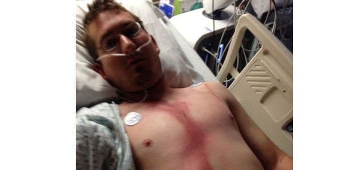 Preživio udar groma u glavu Preživio udar groma u glavu