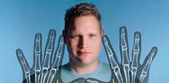 Era kiborga je počela: Umjesto ključa koristite čip! Era kiborga je počela: Umjesto ključa koristite čip!