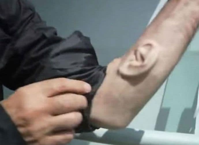 Umjetnik ugradio sebi "treće uvo" u okviru performansa Umjetnik ugradio sebi "treće uvo" u okviru performansa