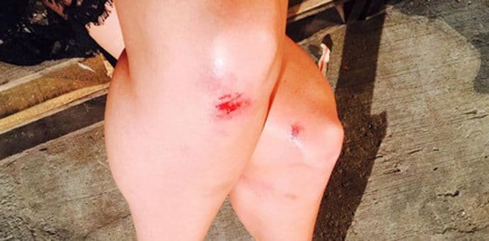 Slavna manekenka pala na reviji (VIDEO) Slavna manekenka pala na reviji (VIDEO)