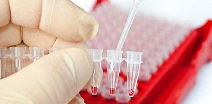 DNK nanouređaj otkriva HIV za samo pet minuta DNK nanouređaj otkriva HIV za samo pet minuta