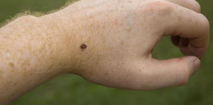 Da li znate šta je lajmska bolest i kako se liječi? Da li znate šta je lajmska bolest i kako se liječi?