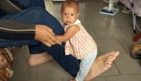 SAVREMENI GULIVER: Čovjek sa najvećim stopalima na svijetu SAVREMENI GULIVER: Čovjek sa najvećim stopalima na svijetu