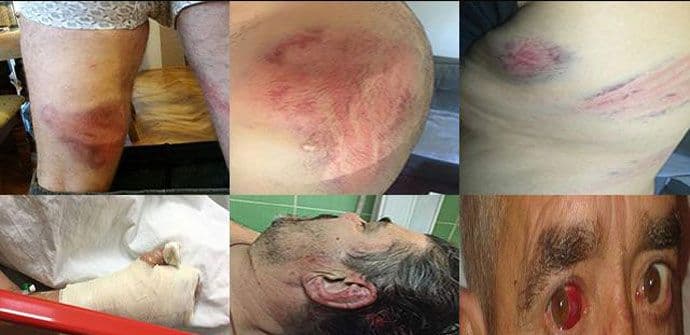 GA objavila slučajeve prekoračenja ovlašćenja policije i zatražila suspenziju komandanta i zamjenika SAJ-a GA objavila slučajeve prekoračenja ovlašćenja policije i zatražila suspenziju komandanta i zamjenika SAJ-a