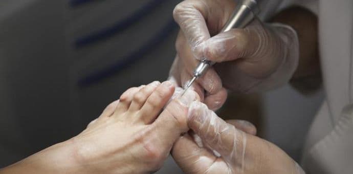 Što otkrivaju promjene na stopalu Što otkrivaju promjene na stopalu