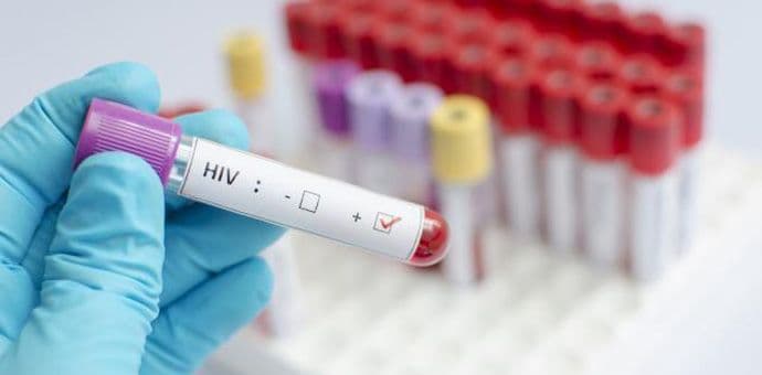 Zabilježen rekordan broj zaraženih HIV-om u Evropi Zabilježen rekordan broj zaraženih HIV-om u Evropi