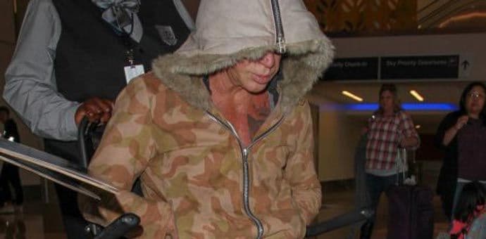 Glumac završio u invalidskim kolicima Glumac završio u invalidskim kolicima