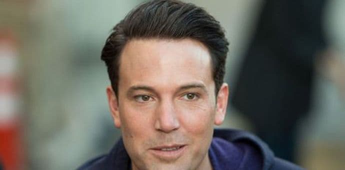 Ben Aflek zbog plastičnih operacija više ne liči na sebe Ben Aflek zbog plastičnih operacija više ne liči na sebe