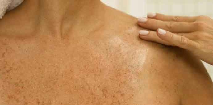 Promjene na koži koje mogu da ukažu na ozbiljne probleme Promjene na koži koje mogu da ukažu na ozbiljne probleme