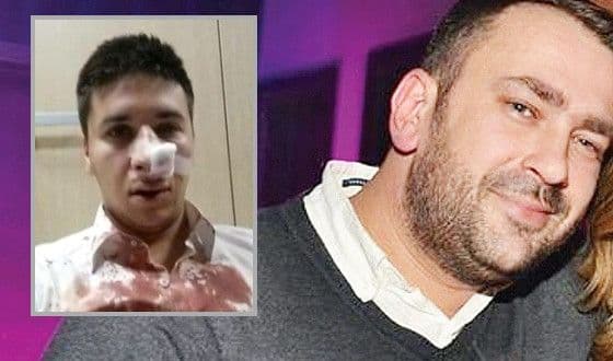 Svjedoci nijesu vidjeli šta se dešavalo ispred lokala ''Stefan Braun'' Svjedoci nijesu vidjeli šta se dešavalo ispred lokala ''Stefan Braun''