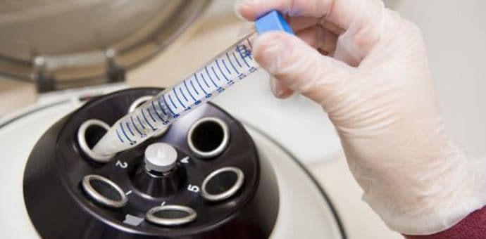 O trošku države 437 postupka vantjelesne oplodnje O trošku države 437 postupka vantjelesne oplodnje