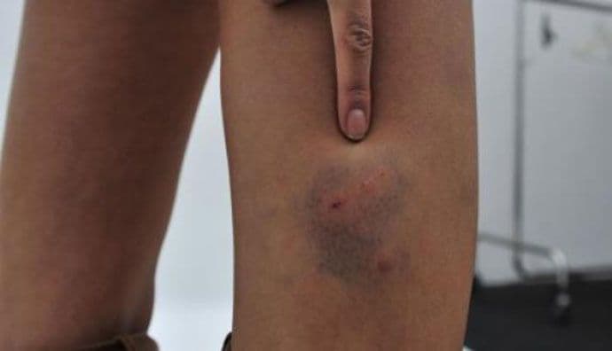 Ujedi pasa lutalica olakšali opštinske budžete za 8,2 miliona eura Ujedi pasa lutalica olakšali opštinske budžete za 8,2 miliona eura