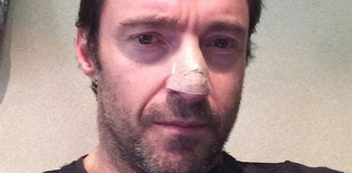 Glumac pred publikom nakon šeste operacije tumora Glumac pred publikom nakon šeste operacije tumora