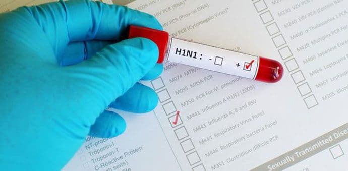 Medicinska sestra iz Bara druga žrtva virusa H1N1 Medicinska sestra iz Bara druga žrtva virusa H1N1