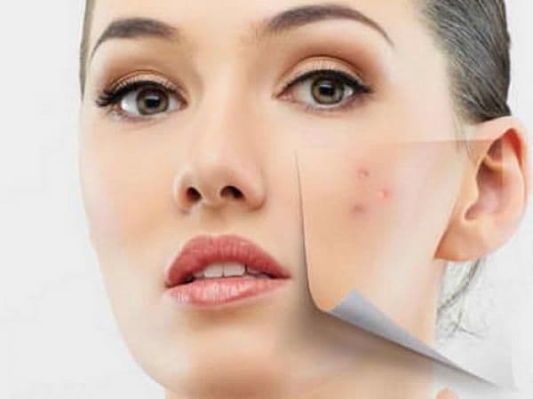 Kako nam koža pokazuje šta treba da promijenimo u životu Kako nam koža pokazuje šta treba da promijenimo u životu