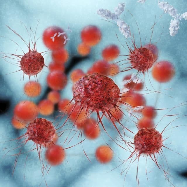 Simptom koji se često ignoriše: Ova grupa ljudi ima 80 odsto veće šanse da oboli od raka grla Simptom koji se često ignoriše: Ova grupa ljudi ima 80 odsto veće šanse da oboli od raka grla