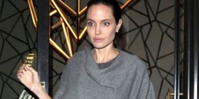 FOTOGRAFIJA KOJA JE ŠOKIRALA SVIJET: Anđelina ima 35 kilograma FOTOGRAFIJA KOJA JE ŠOKIRALA SVIJET: Anđelina ima 35 kilograma