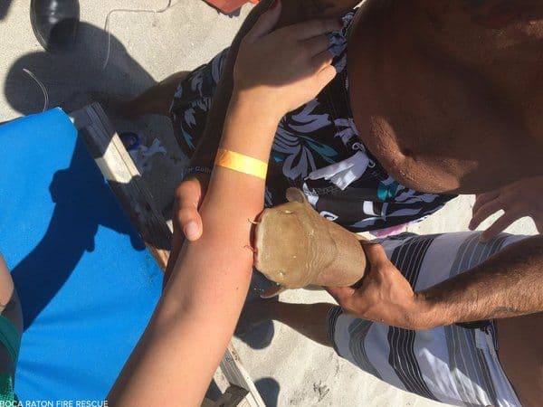 Ženu odvezli u bolnicu sa ajkulom na ruci Ženu odvezli u bolnicu sa ajkulom na ruci