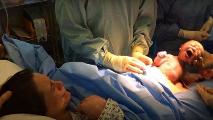 Video: Prirodni carski rez, doktori puste bebu da izmigolji sama Video: Prirodni carski rez, doktori puste bebu da izmigolji sama