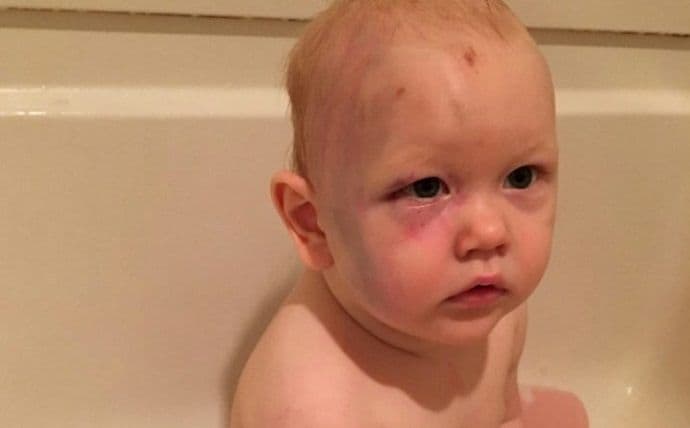 Skoro ubio bebu, ali nije uhapšen jer ga mališan ne može identifikovati Skoro ubio bebu, ali nije uhapšen jer ga mališan ne može identifikovati