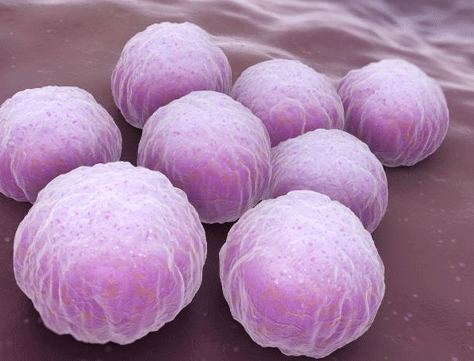 Znakovi da ste se zaraženi opasnom bakterijom: Širi se svuda po tijelu, izaziva neplodnost Znakovi da ste se zaraženi opasnom bakterijom: Širi se svuda po tijelu, izaziva neplodnost