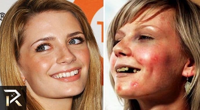 Top 10 slavnih ličnosti koje je droga potpuno uništila Top 10 slavnih ličnosti koje je droga potpuno uništila