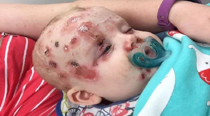 Pogledajte šta može da se desi ako ne vakcinišete bebu Pogledajte šta može da se desi ako ne vakcinišete bebu