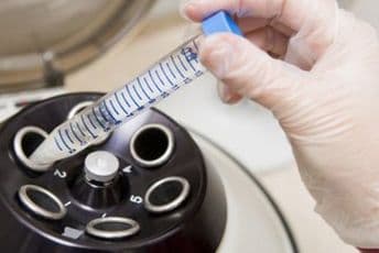 Vantjelesna oplodnja za 370 parova koštala 700.000 eura Vantjelesna oplodnja za 370 parova koštala 700.000 eura