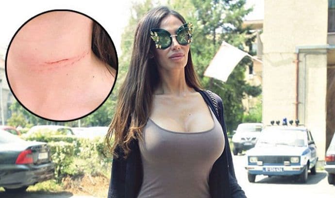 Soraja: Oprostila sam Stefanu što me je klao Soraja: Oprostila sam Stefanu što me je klao