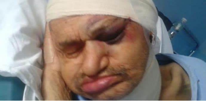 Sinovac pretučenog starca: Odgovorni da odgovaraju Sinovac pretučenog starca: Odgovorni da odgovaraju