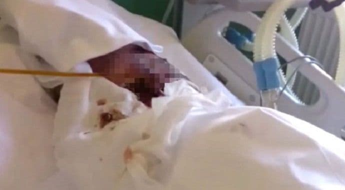 Skandal u Bukureštu: Crvi jeli žive pacijente (Video) Skandal u Bukureštu: Crvi jeli žive pacijente (Video)