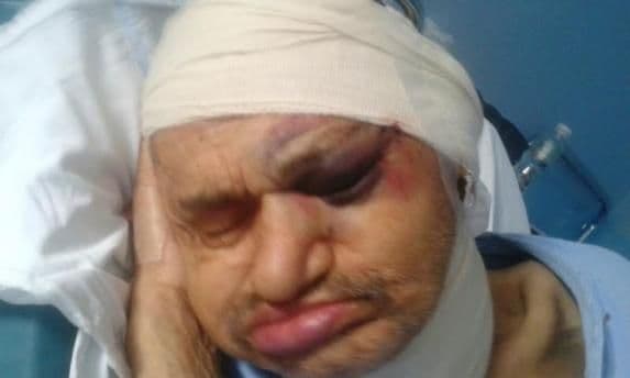 Još se ne zna ko je od nadležnih kriv za prebijanje starca Još se ne zna ko je od nadležnih kriv za prebijanje starca