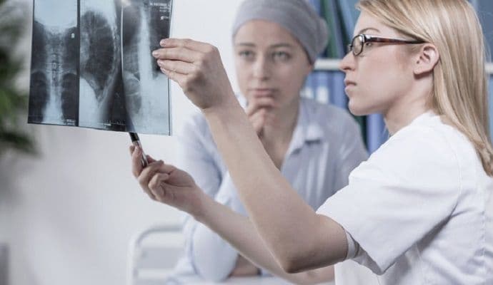 Pet upozoravajućih znakova raka za mlađe ljude Pet upozoravajućih znakova raka za mlađe ljude