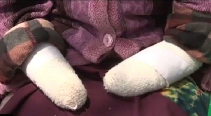 VIDEO: Mačetom odsjekao ženi šake jer nije ostala trudna VIDEO: Mačetom odsjekao ženi šake jer nije ostala trudna