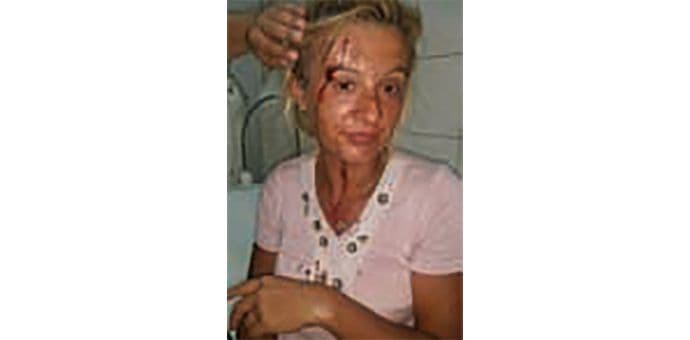 Pretukao sestru od strica zbog imovine Pretukao sestru od strica zbog imovine