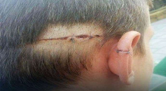 Dječak pokušao da pomogne migrantu, on ga isjekao skalpelom po glavi Dječak pokušao da pomogne migrantu, on ga isjekao skalpelom po glavi