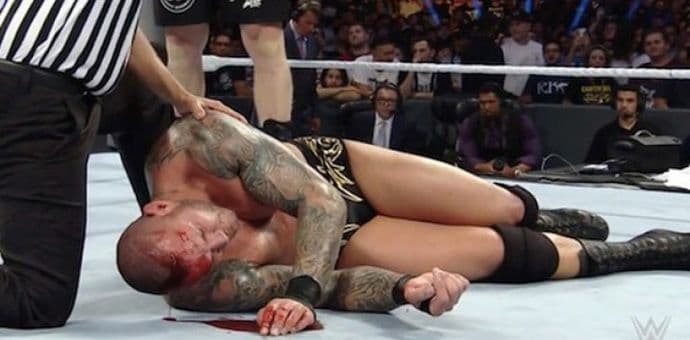 Kečersku borbu pretvorio u rijeku krvi, razbio glavu protivnika (VIDEO) Kečersku borbu pretvorio u rijeku krvi, razbio glavu protivnika (VIDEO)