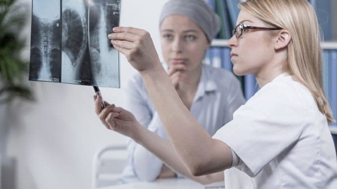 Upozoravajući simptomi 4 najčešća tipa raka Upozoravajući simptomi 4 najčešća tipa raka