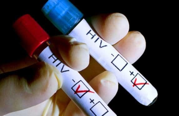 Djevojčica rođena sa HIV-om živi normalno bez ljekova Djevojčica rođena sa HIV-om živi normalno bez ljekova