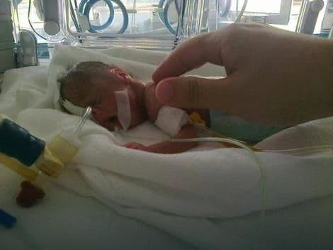 ODBIO DA UMRE: Kako je mali Vuk, rođen sa 470 grama, pobio sve prognoze ljekara ODBIO DA UMRE: Kako je mali Vuk, rođen sa 470 grama, pobio sve prognoze ljekara